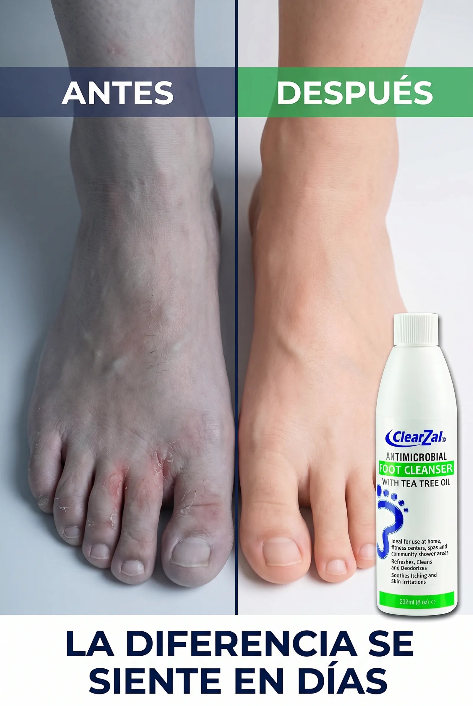 clearzal-foot-cleanser — 05_antes_despues